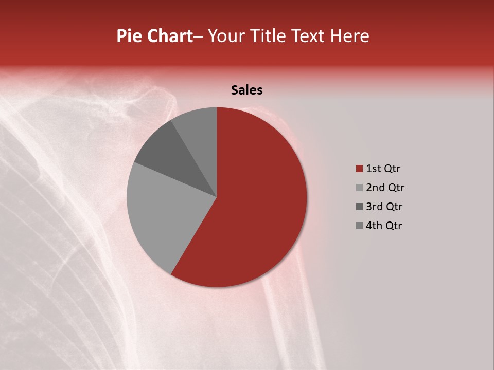 Medical Injury Humeral PowerPoint Template