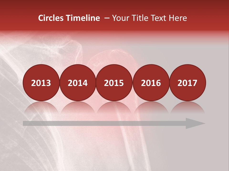 Medical Injury Humeral PowerPoint Template