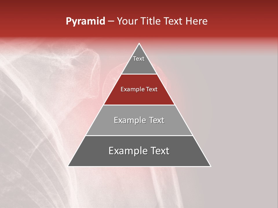 Medical Injury Humeral PowerPoint Template