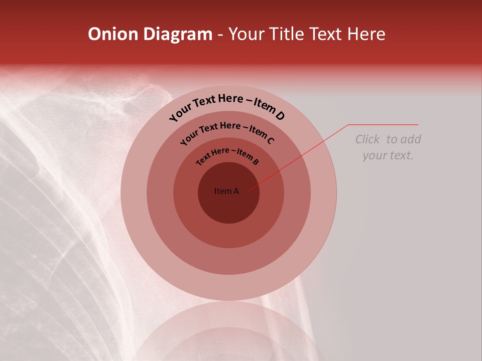 Medical Injury Humeral PowerPoint Template