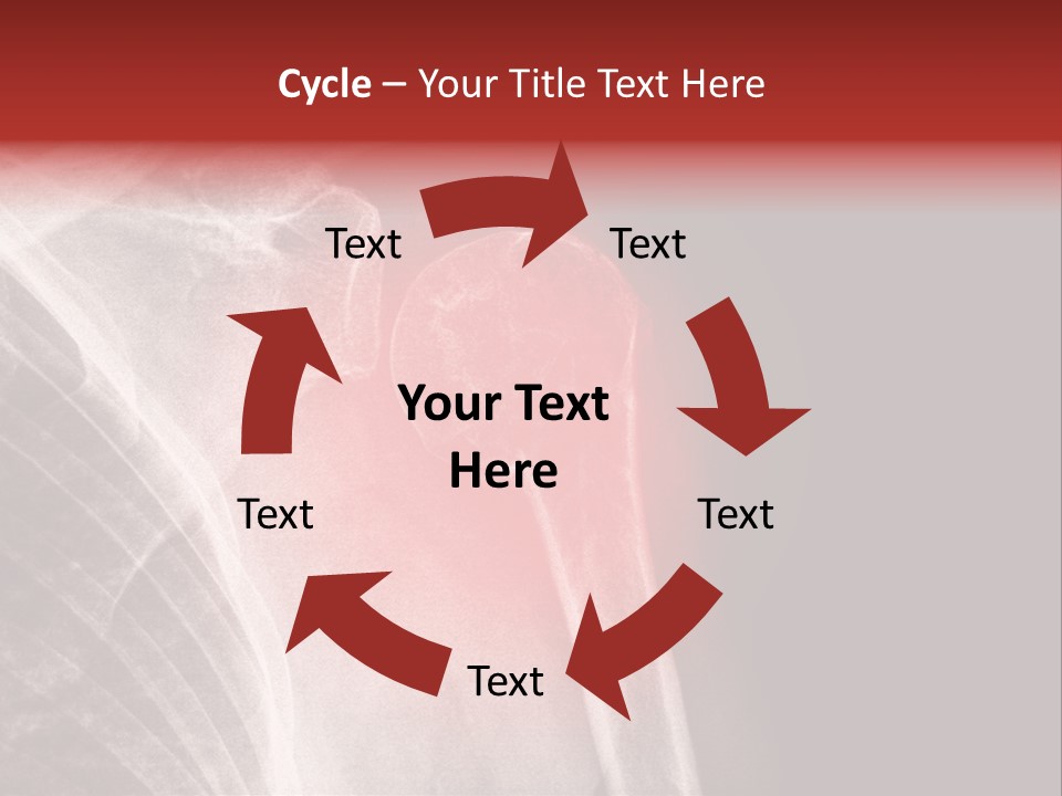 Medical Injury Humeral PowerPoint Template