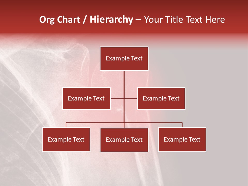 Medical Injury Humeral PowerPoint Template