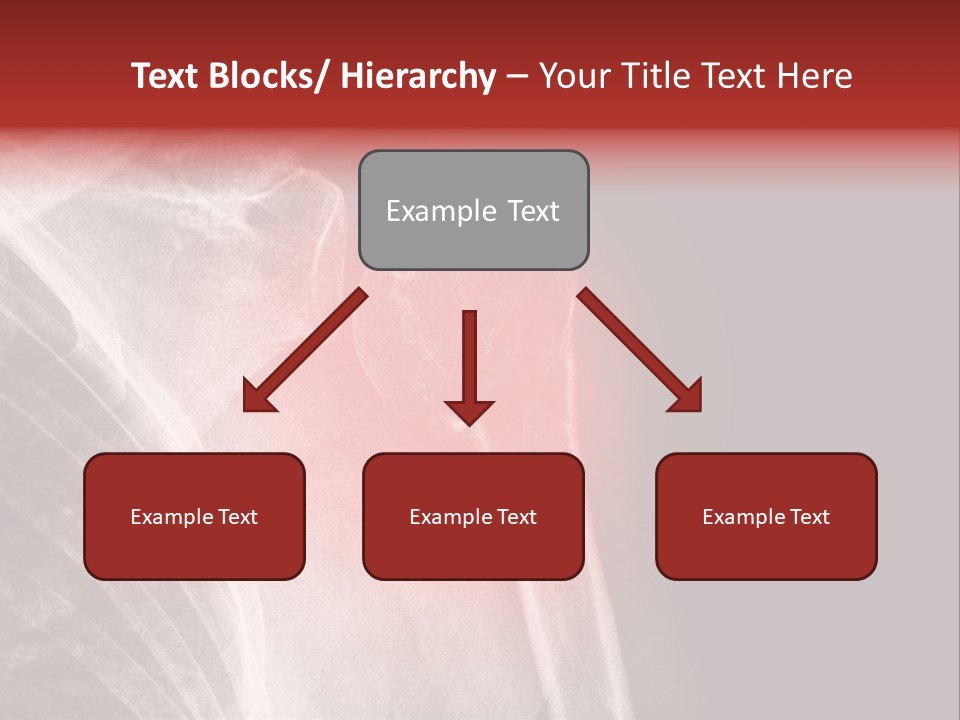 Medical Injury Humeral PowerPoint Template