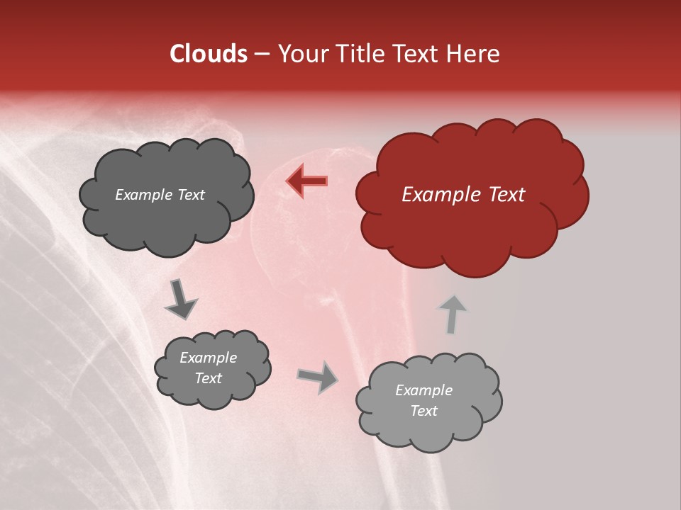 Medical Injury Humeral PowerPoint Template