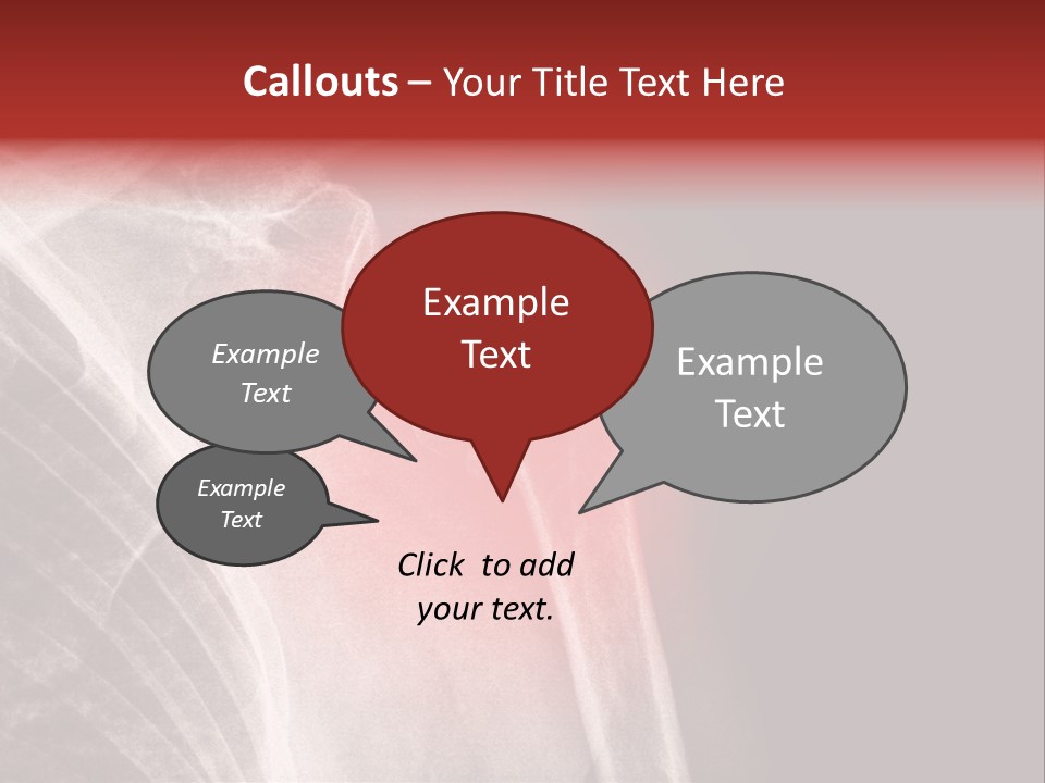 Medical Injury Humeral PowerPoint Template