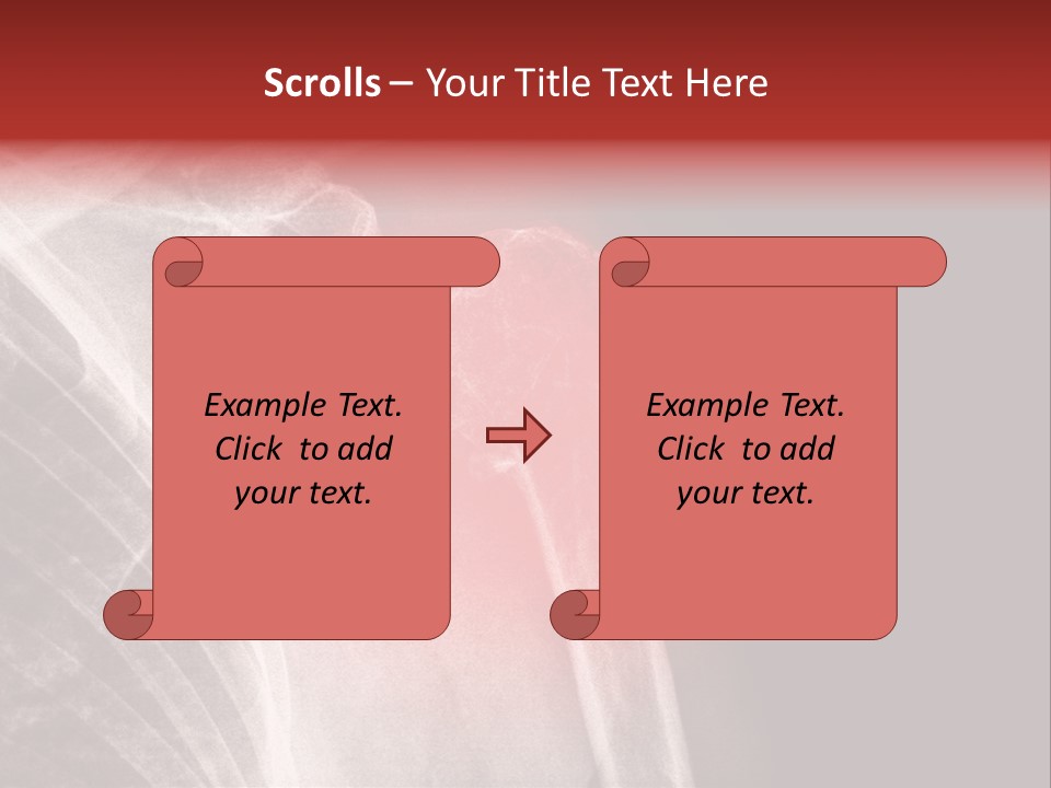 Medical Injury Humeral PowerPoint Template