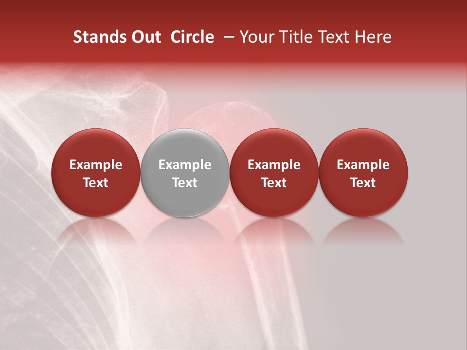 Medical Injury Humeral PowerPoint Template