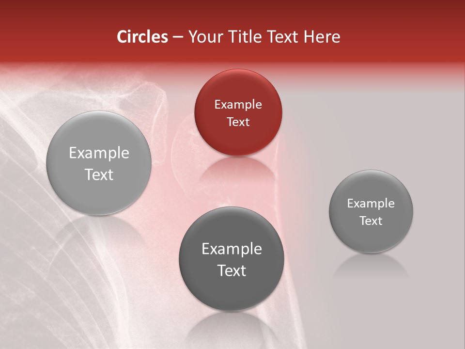 Medical Injury Humeral PowerPoint Template