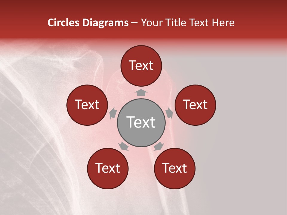 Medical Injury Humeral PowerPoint Template