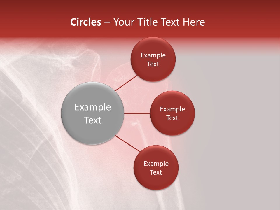 Medical Injury Humeral PowerPoint Template
