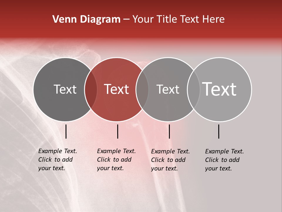 Medical Injury Humeral PowerPoint Template