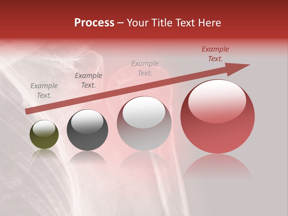 Medical Injury Humeral PowerPoint Template