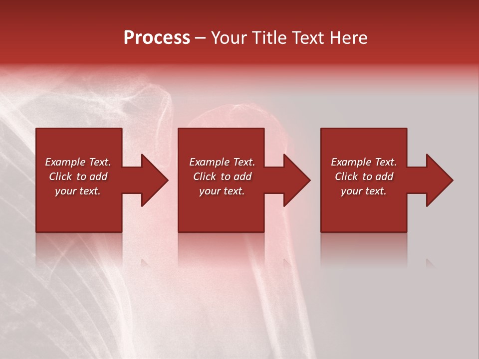 Medical Injury Humeral PowerPoint Template