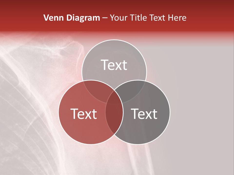 Medical Injury Humeral PowerPoint Template