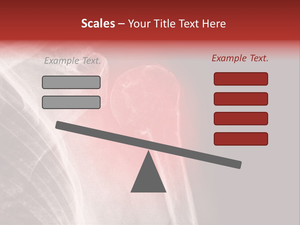 Medical Injury Humeral PowerPoint Template