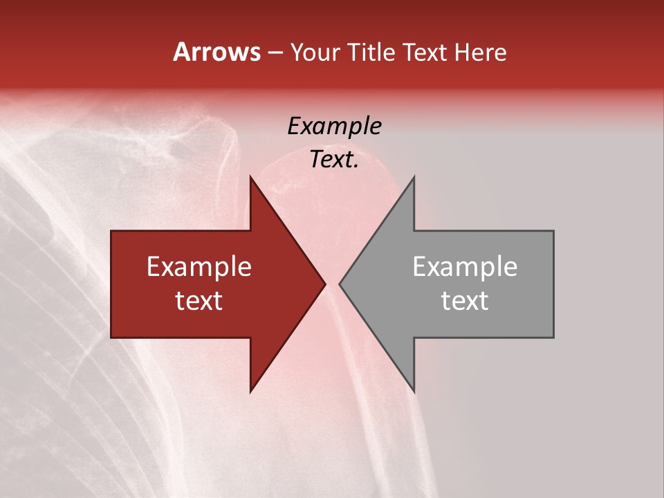 Medical Injury Humeral PowerPoint Template