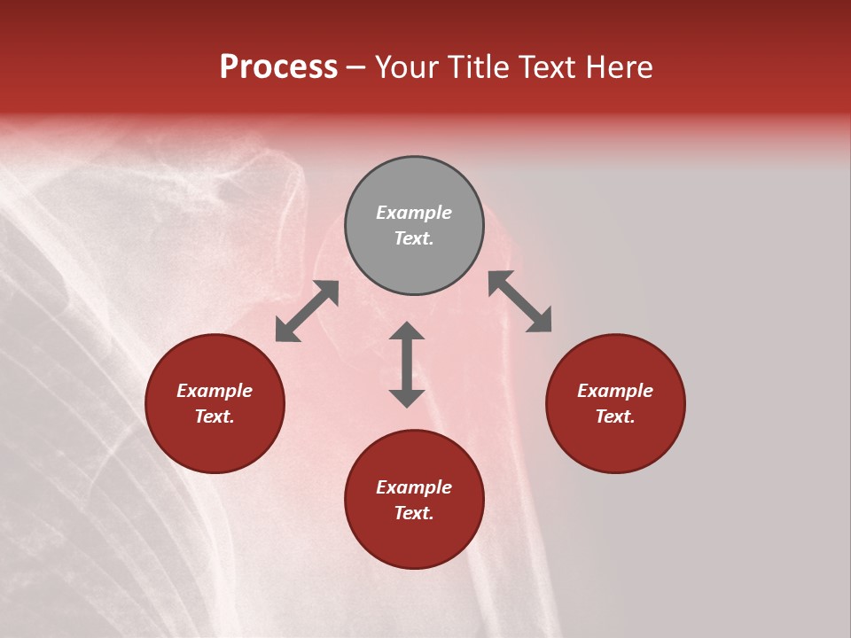 Medical Injury Humeral PowerPoint Template