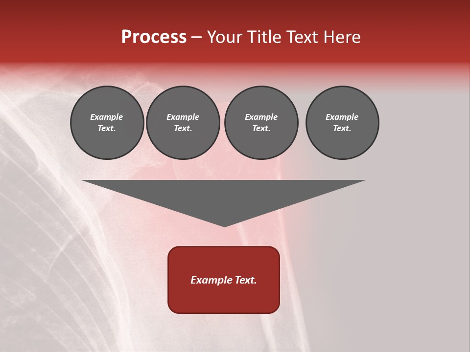 Medical Injury Humeral PowerPoint Template
