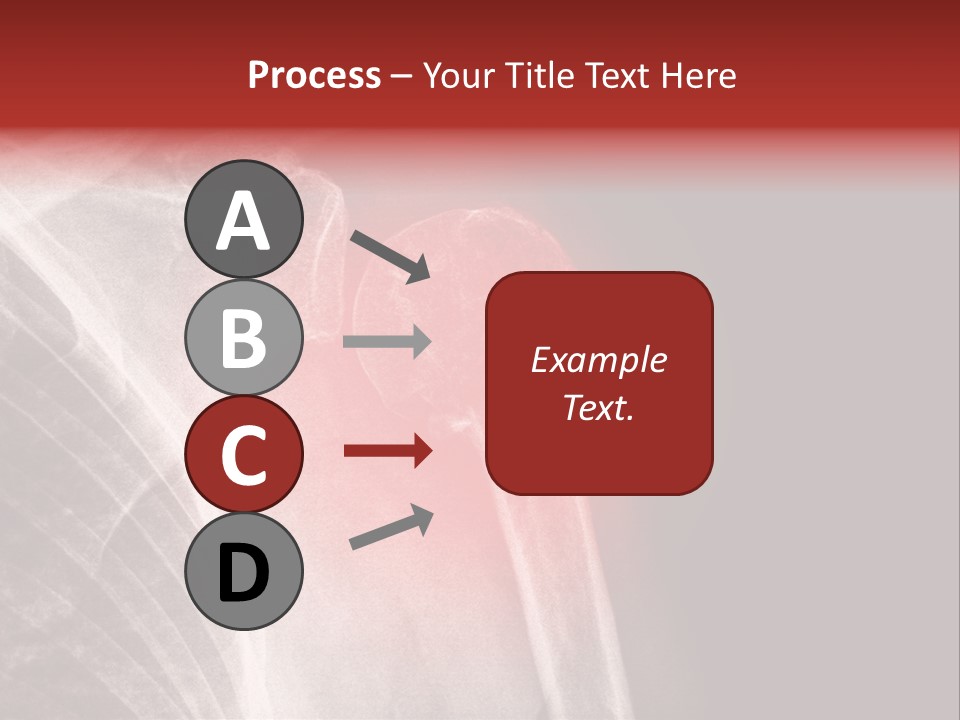 Medical Injury Humeral PowerPoint Template