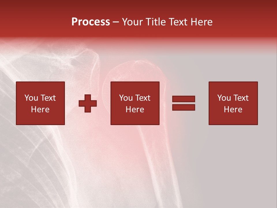 Medical Injury Humeral PowerPoint Template