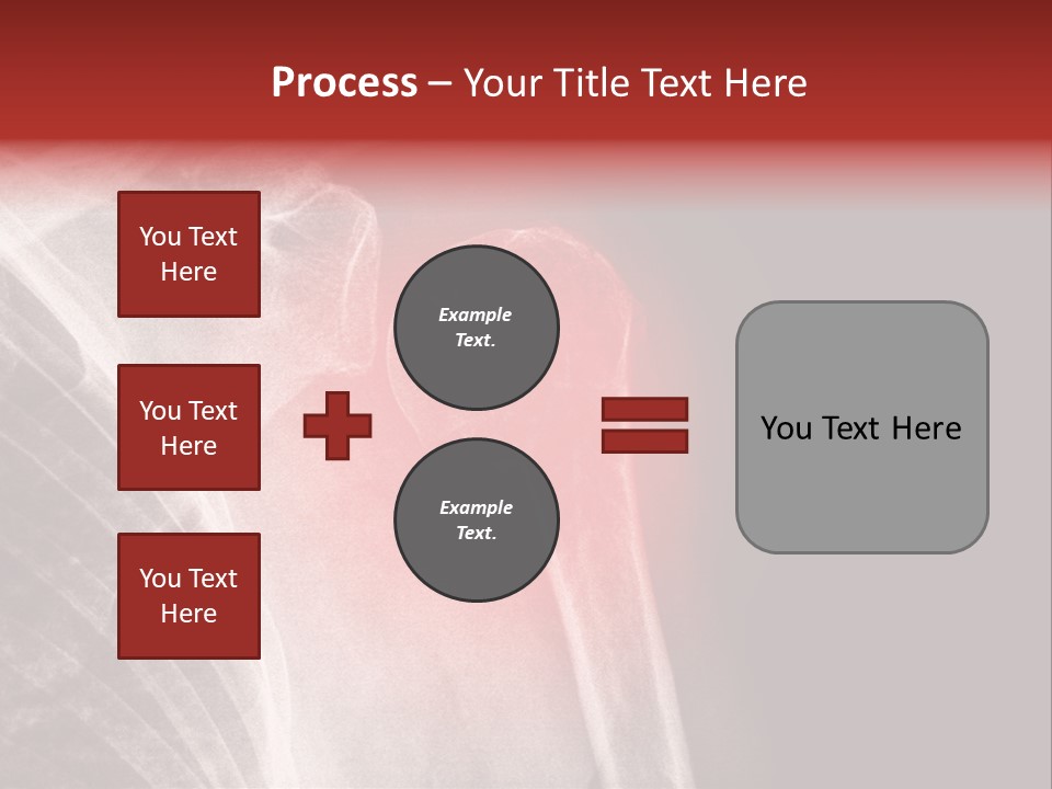 Medical Injury Humeral PowerPoint Template