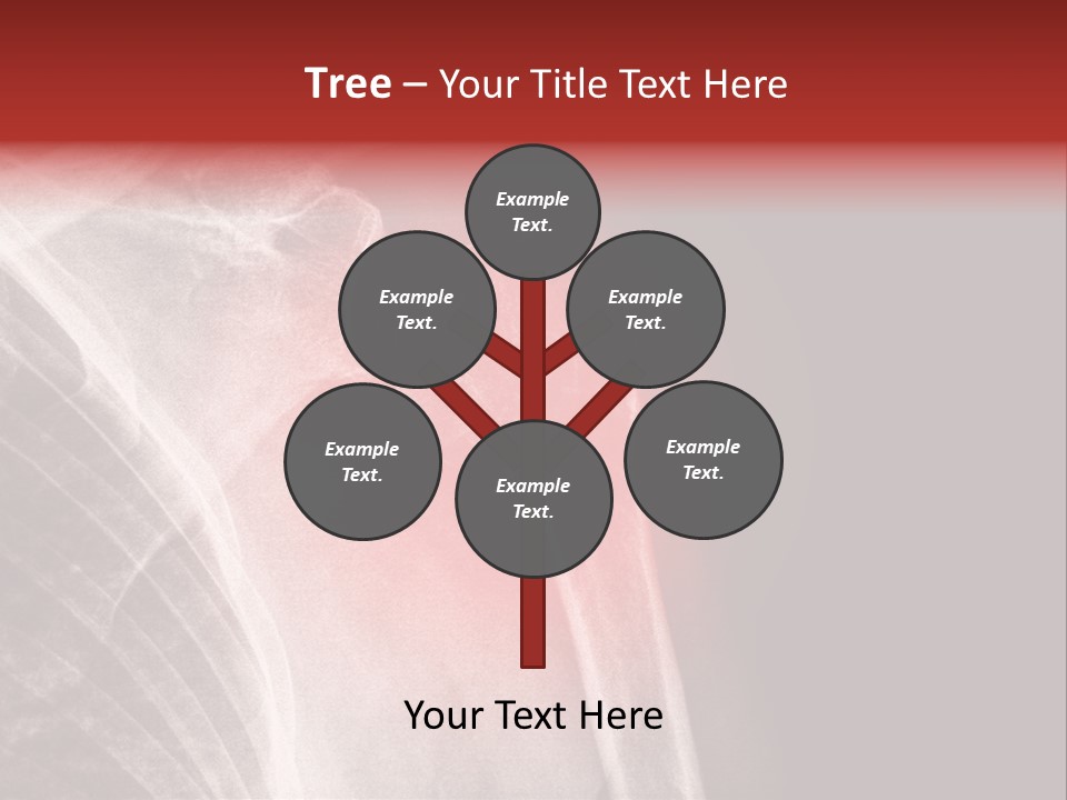 Medical Injury Humeral PowerPoint Template