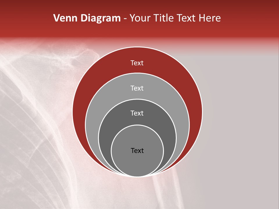Medical Injury Humeral PowerPoint Template