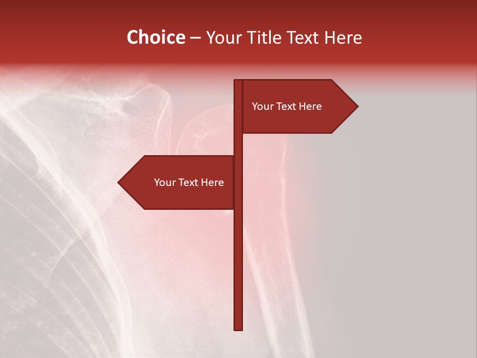Medical Injury Humeral PowerPoint Template