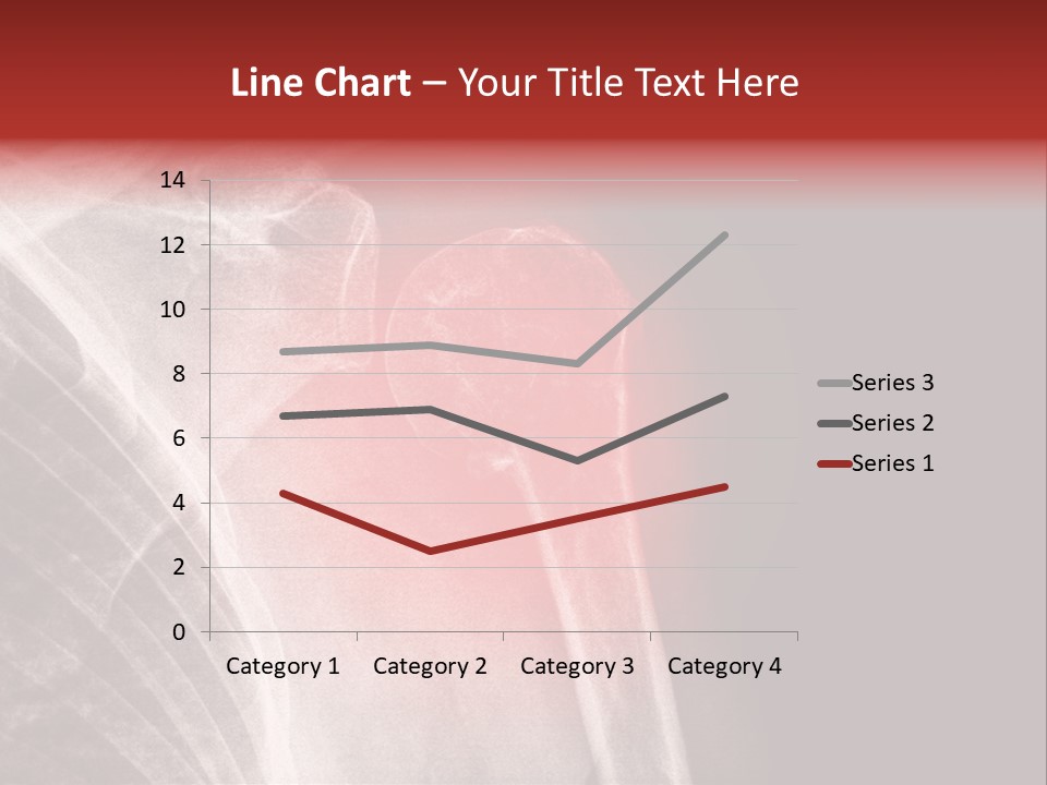 Medical Injury Humeral PowerPoint Template