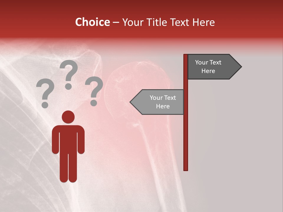 Medical Injury Humeral PowerPoint Template