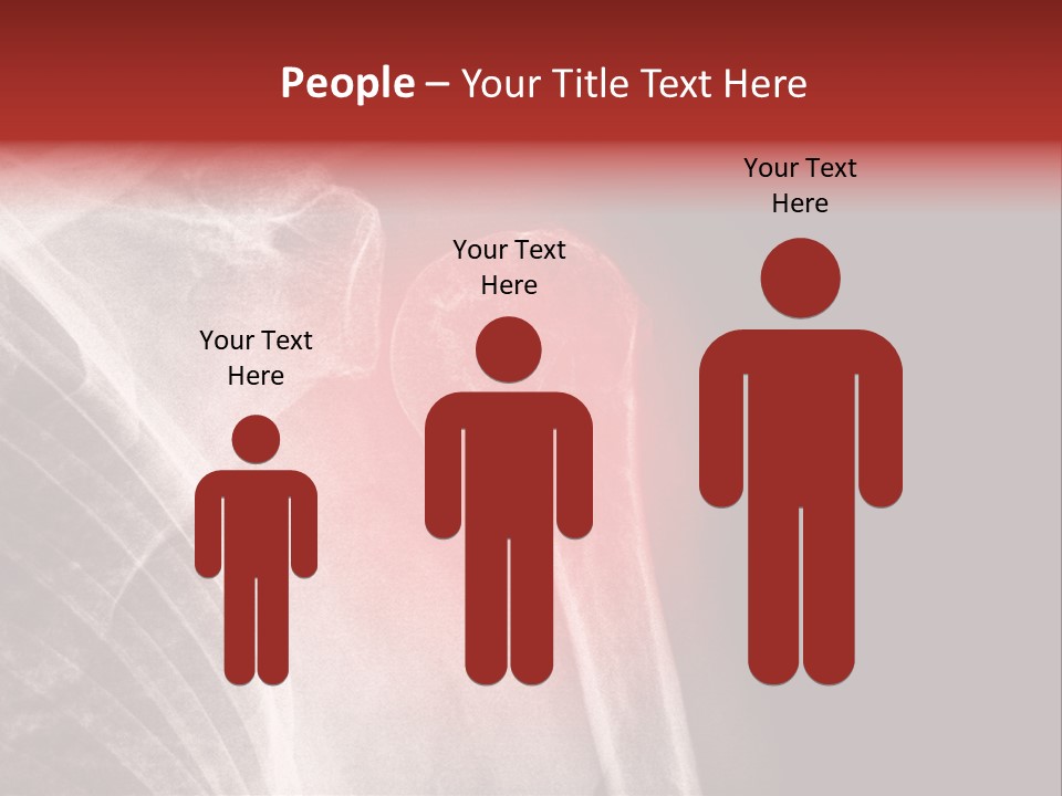 Medical Injury Humeral PowerPoint Template