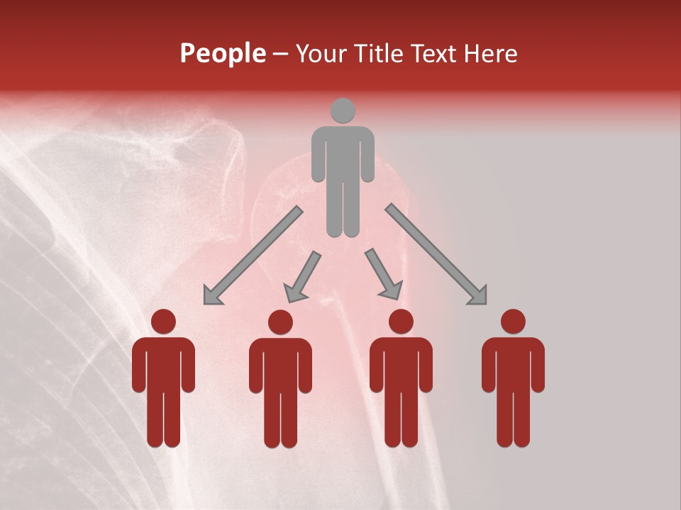 Medical Injury Humeral PowerPoint Template