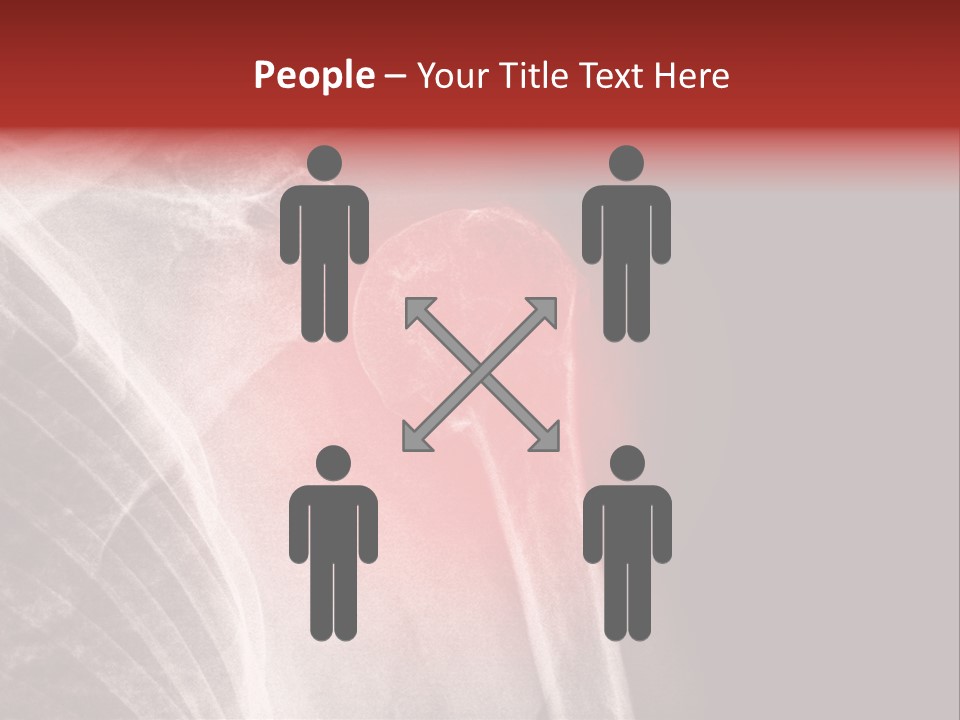 Medical Injury Humeral PowerPoint Template