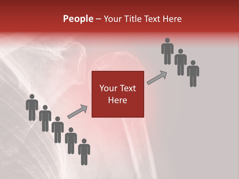 Medical Injury Humeral PowerPoint Template