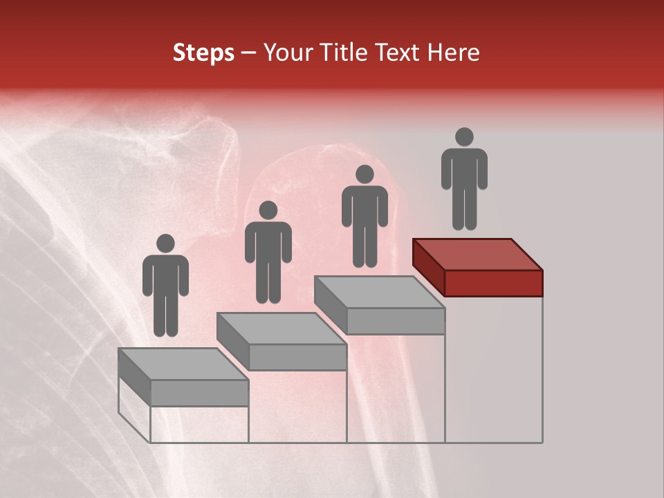 Medical Injury Humeral PowerPoint Template
