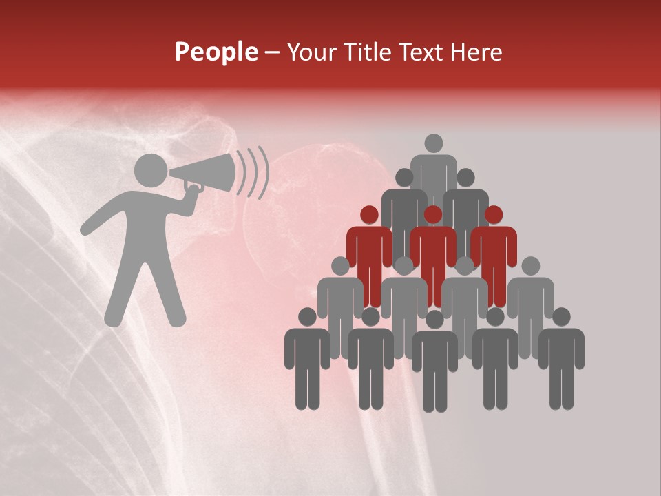 Medical Injury Humeral PowerPoint Template