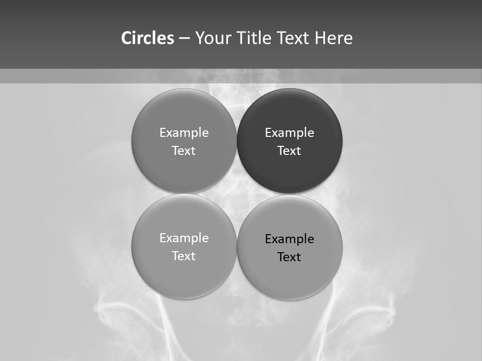 A X - Ray Image Of A Skeleton With The Words Name Of Presentation Company Name PowerPoint Template