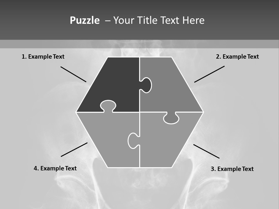 A X - Ray Image Of A Skeleton With The Words Name Of Presentation Company Name PowerPoint Template