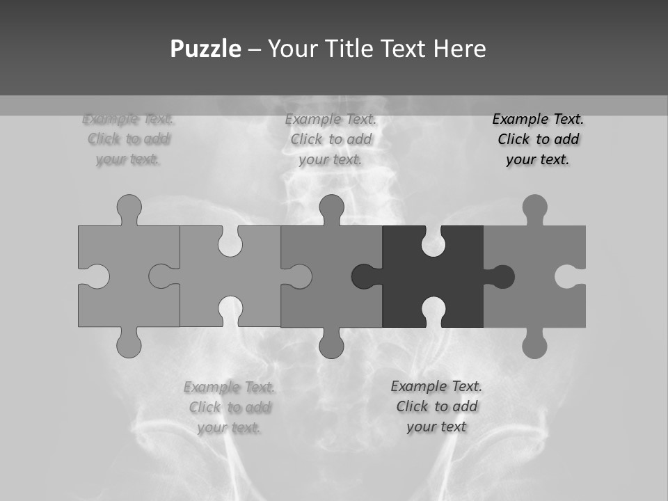 A X - Ray Image Of A Skeleton With The Words Name Of Presentation Company Name PowerPoint Template