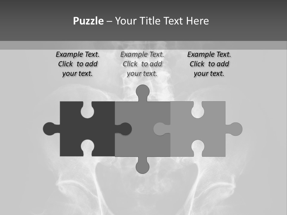 A X - Ray Image Of A Skeleton With The Words Name Of Presentation Company Name PowerPoint Template