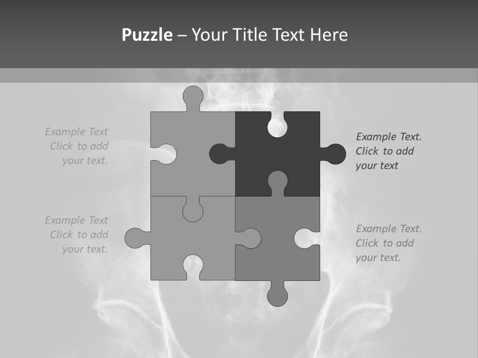 A X - Ray Image Of A Skeleton With The Words Name Of Presentation Company Name PowerPoint Template