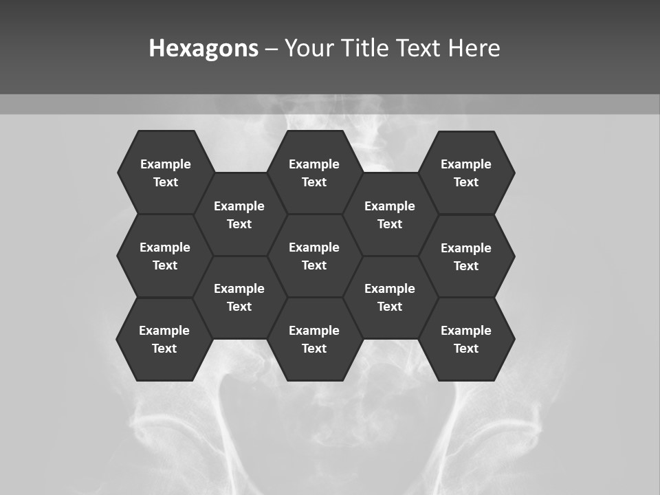 A X - Ray Image Of A Skeleton With The Words Name Of Presentation Company Name PowerPoint Template