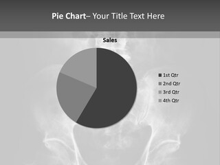 A X - Ray Image Of A Skeleton With The Words Name Of Presentation Company Name PowerPoint Template