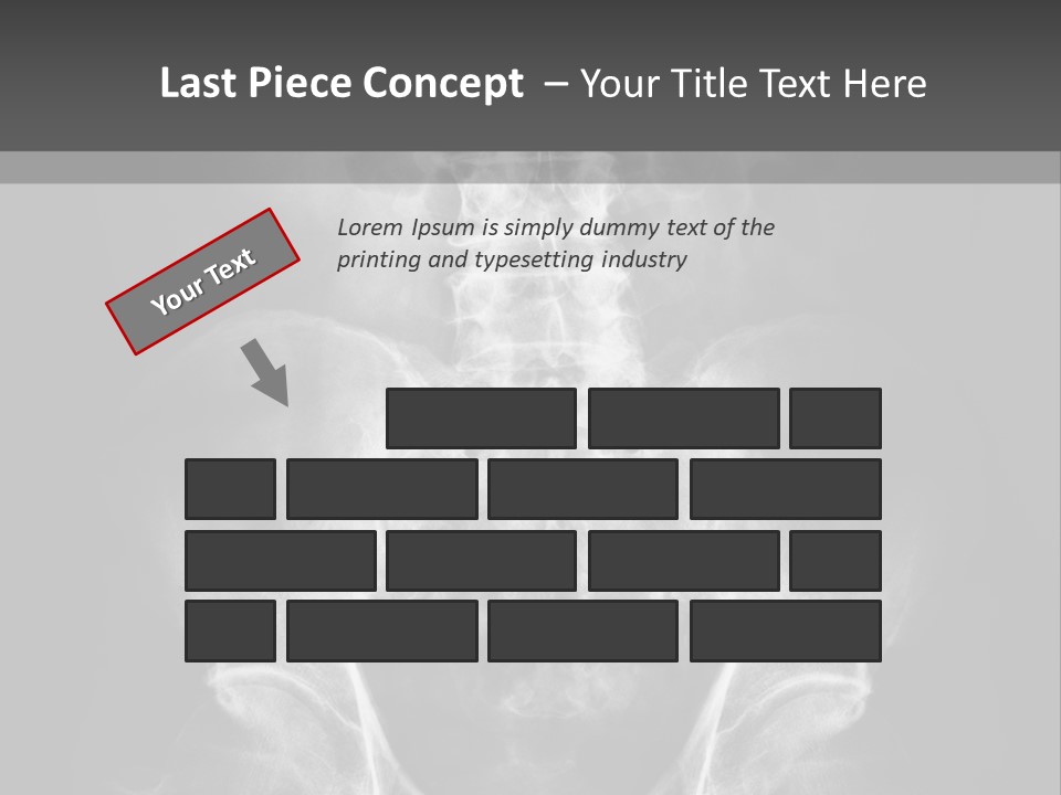 A X - Ray Image Of A Skeleton With The Words Name Of Presentation Company Name PowerPoint Template