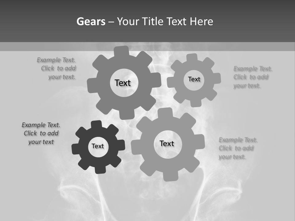 A X - Ray Image Of A Skeleton With The Words Name Of Presentation Company Name PowerPoint Template