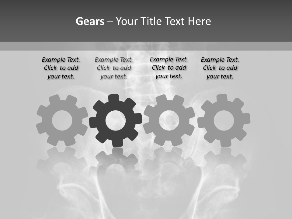 A X - Ray Image Of A Skeleton With The Words Name Of Presentation Company Name PowerPoint Template