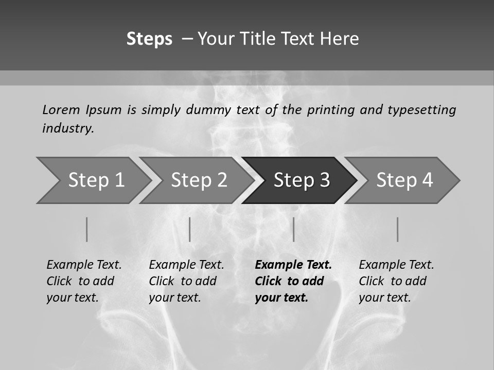 A X - Ray Image Of A Skeleton With The Words Name Of Presentation Company Name PowerPoint Template