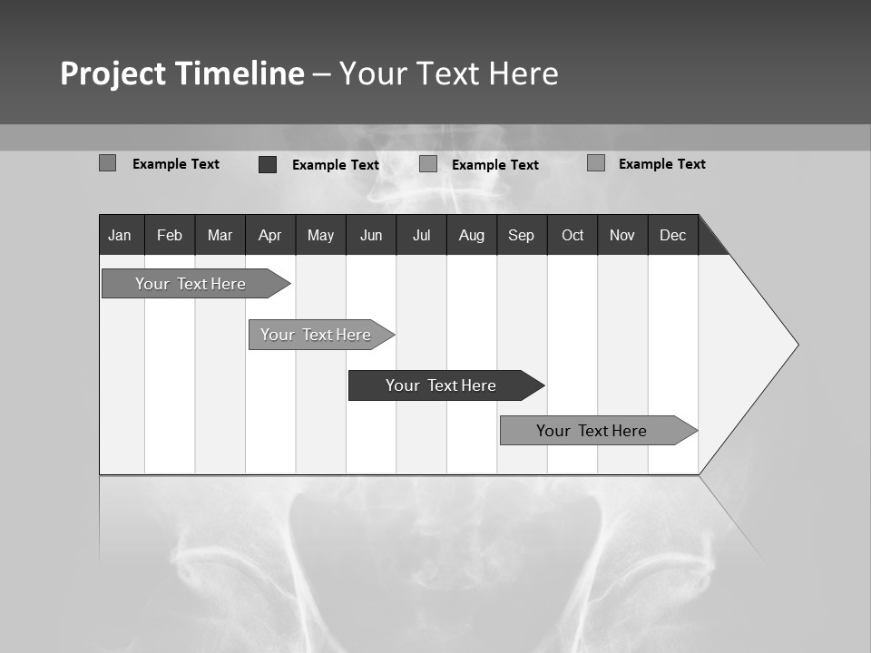 A X - Ray Image Of A Skeleton With The Words Name Of Presentation Company Name PowerPoint Template