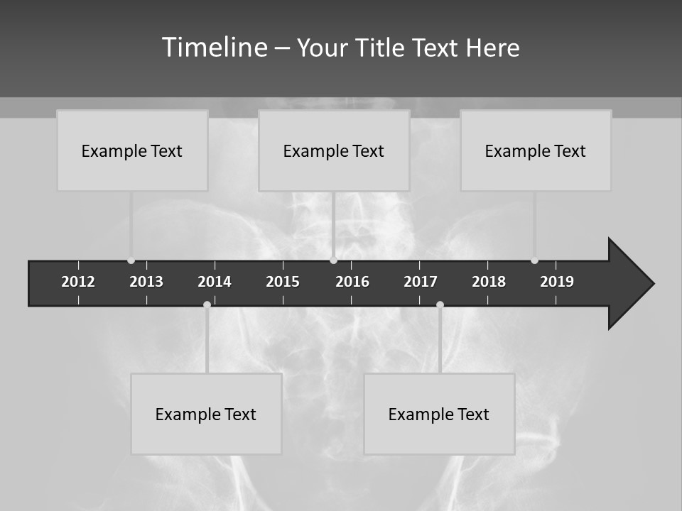 A X - Ray Image Of A Skeleton With The Words Name Of Presentation Company Name PowerPoint Template