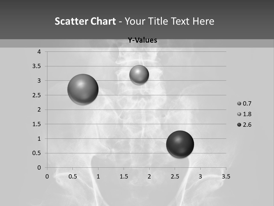 A X - Ray Image Of A Skeleton With The Words Name Of Presentation Company Name PowerPoint Template